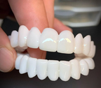 Removable Moldable Dental Veneers, Reusable Natural Fit