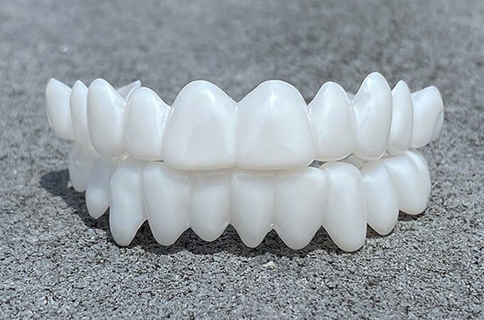 Removable Moldable Dental Veneers, Reusable Natural Fit