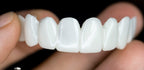 Removable Moldable Dental Veneers, Reusable Natural Fit
